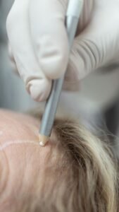 Precisione nei trattamenti estetici.